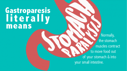 Gastroparesis Infographic